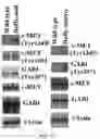 Fig. 25 - CANCER DETECTION UTILIZING NORMAL TISSUE ADJACENT TO BREAST TUMORS WITH GENETIC ANCESTRY-MAPPING