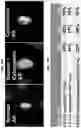Fig. 14 - CIRCULATING TUMOR CELL DIAGNOSTICS FOR IDENTIFICATION OF RESISTANCE TO ANDROGEN RECEPTOR TARGETED THERAPIES