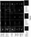 Fig. 06 - CIRCULATING TUMOR CELL DIAGNOSTICS FOR BIOMARKERS PREDICTIVE OF RESISTANCE TO ANDROGEN RECEPTOR (AR) TARGETED THERAPIES