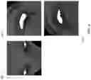 Fig. 05 - Camera reprojection for faces