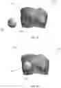 Fig. 02 - Oncoplastic surgery training model