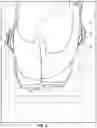 Fig. 06 - Article of footwear with zonal cushioning system