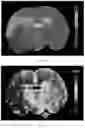 Fig. 08 - Method for determining ischemic status or assessing stroke onset time of a brain region