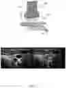 Fig. 05 - Systems and methods for guided ultrasound data acquisition