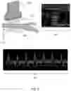 Fig. 07 - Systems and methods for guided ultrasound data acquisition