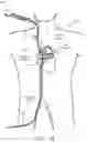 Fig. 02 - SUTURE MANAGEMENT DEVICE AND METHODS