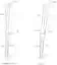Fig. 02 - Adjustable devices for treating arthritis of the knee