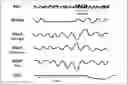 Fig. 01 - METHODS AND COMPOSITIONS FOR TREATING SLEEP APNEA