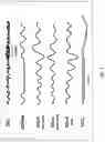 Fig. 02 - METHODS AND COMPOSITIONS FOR TREATING SLEEP APNEA