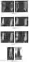 Fig. 07 - PSMA BINDING LIGAND-LINKER CONJUGATES AND METHODS FOR USING