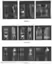 Fig. 08 - PSMA BINDING LIGAND-LINKER CONJUGATES AND METHODS FOR USING
