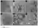 Fig. 02 - METHOD AND PHARMACOLOGICAL COMPOSITION FOR THE PREVENTION OF RECURRENT INFECTIONS CAUSED BY CLOSTRIDIUM DIFFICILE