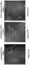 Fig. 49 - Methods and Formulations for Preventing Neurological or Psychiatric Disorders