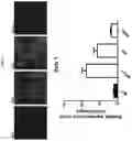 Fig. 05 - Pharmaceutical composition for prevention or treatment of lysosomal storage disorders