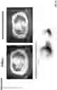Fig. 35 - Modified Cell Expansion and Uses Thereof