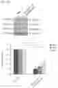 Fig. 08 - COMBINATIONS, NANOPARTICLES AND METHODS FOR CONTROLLING NATURAL KILLER CELL ACTIVATION AND FUNCTION