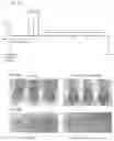 Fig. 15 - COMBINATIONS, NANOPARTICLES AND METHODS FOR CONTROLLING NATURAL KILLER CELL ACTIVATION AND FUNCTION