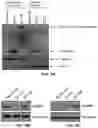 Fig. 04 - METHODS OF TREATING CERVICAL CANCER