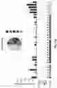Fig. 24 - METHODS OF TREATING CERVICAL CANCER