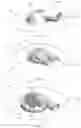 Fig. 06 - WOUND DRAIN