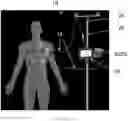 Fig. 01 - SUBARACHNOID FLUID MANAGEMENT METHOD AND SYSTEM