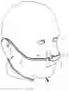 Fig. 03 - Nasal oxygen cannula with device for measuring use time