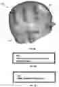 Fig. 08 - Methods and systems for transducer array placement and skin surface condition avoidance