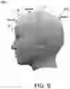 Fig. 07 - Portable Stimulation Systems and Methods