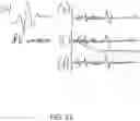 Fig. 09 - Portable Stimulation Systems and Methods