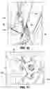 Fig. 08 - Golf bag convertible strap assembly