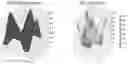 Fig. 01 - ANALYTE DETECTION METHODS AND APPARATUS USING DIELECTROPHORESIS AND ELECTROOSMOSIS