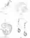 Fig. 07 - Cart
