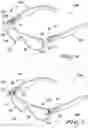 Fig. 03 - ELECTRONIC EYEGLASSES