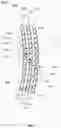 Fig. 07 - Electro-active lens with resistive arcs