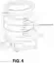 Fig. 12 - Securing Bracket