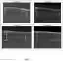 Fig. 08 - COLORED PHOTOSENSITIVE RESIN COMPOSITION AND BLACK MATRIX PREPARED THEREFROM