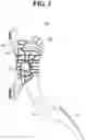 Fig. 04 - Pedal apparatus for vehicle