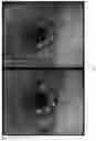 Fig. 04 - Eye tracking device and a method thereof