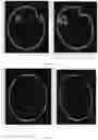 Fig. 06 - Eye tracking device and a method thereof