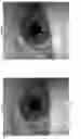 Fig. 07 - Eye tracking device and a method thereof