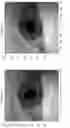 Fig. 08 - Eye tracking device and a method thereof