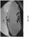 Fig. 08 - Vehicular vision system with object classification