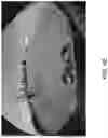 Fig. 09 - Vehicular vision system with object classification