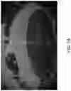 Fig. 11 - Vehicular vision system with object classification