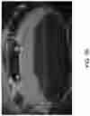 Fig. 12 - Vehicular vision system with object classification