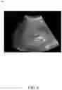 Fig. 07 - SYSTEM AND METHOD FOR STYLIZING A MEDICAL IMAGE