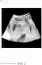 Fig. 09 - SYSTEM AND METHOD FOR STYLIZING A MEDICAL IMAGE