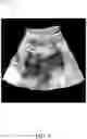 Fig. 10 - SYSTEM AND METHOD FOR STYLIZING A MEDICAL IMAGE