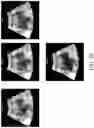Fig. 11 - SYSTEM AND METHOD FOR STYLIZING A MEDICAL IMAGE