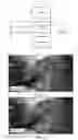 Fig. 02 - METHOD AND SYSTEM FOR COMBINING COMPUTER VISION TECHNIQUES TO IMPROVE SEGMENTATION AND CLASSIFICATION OF A SURGICAL SITE